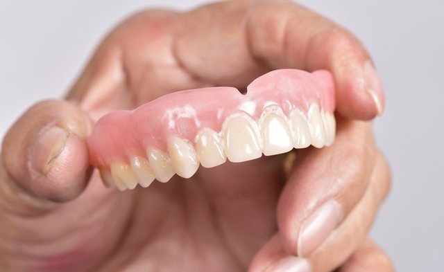 Dental implants in Zirakpur,