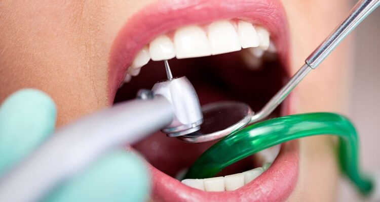 Dental Implant in Mohali